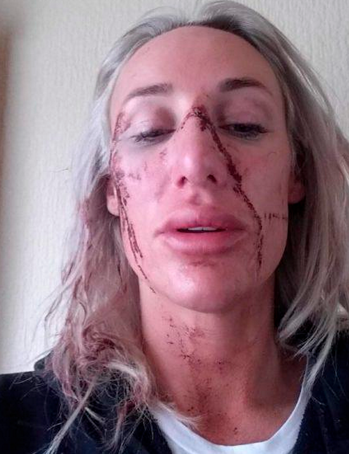 Nu quan nhan bi tinh cu ham hiep, tra tan suot 9 gio-Hinh-2