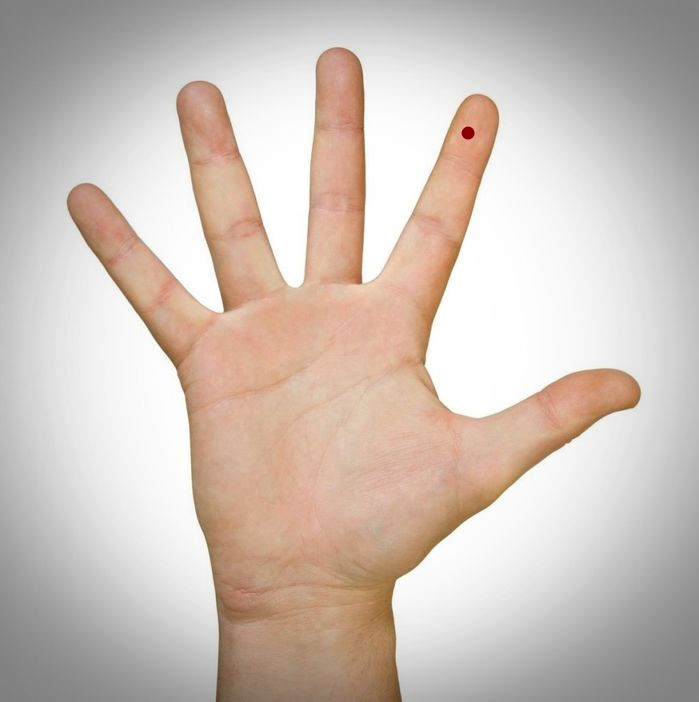 Vi tri not ruoi son chung to ban la mot nguoi cuc may man