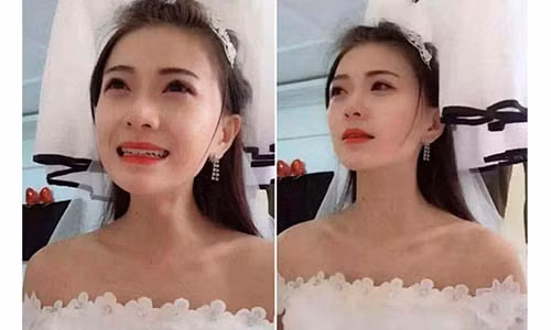 Co dau bat qua tang chu re va phu dau dang man nong