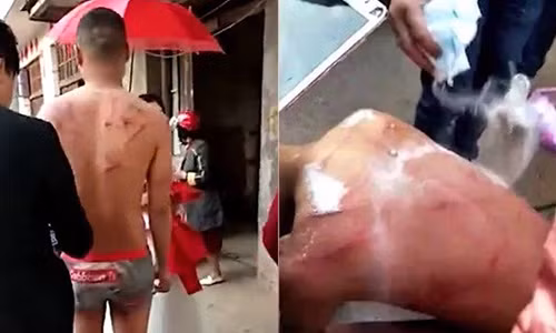 Chú rể bị quất roi, rồi bị xát muối lên vết thương hở trên lưng ngay trong ngày cưới. Ảnh: Shanghaiist