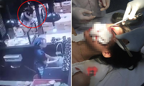 Đang ăn cùng bạn, cô gái (ảnh phải) bị thanh niên bàn bên ném cốc rách mặt.