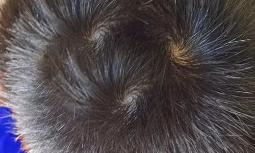 Dem xoay tren dinh dau con tien doan van menh chinh xac