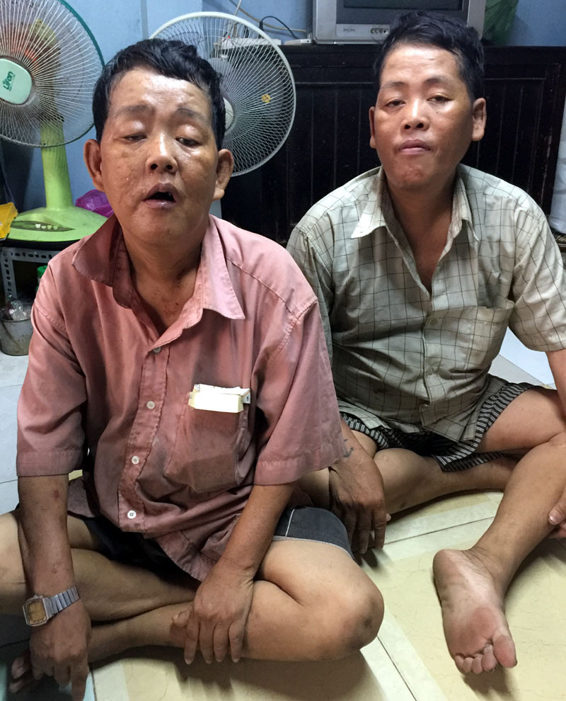 Hai anh em bị bệnh tâm thần.