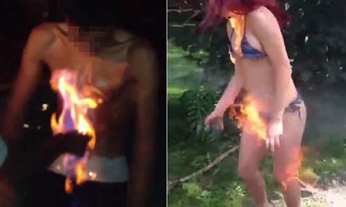 Giới trẻ đặt cược tính mạng với trào lưu ngu xuẩn "thử thách lửa" Gioi tre dat cuoc tinh mang voi trao luu ngu xuan