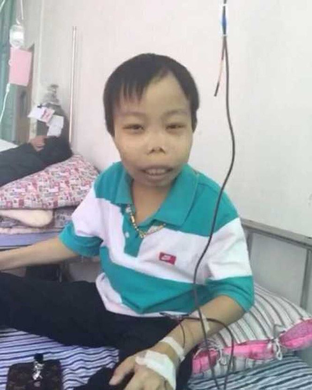 Thời điểm đó, Trần Sơn lên tiếng phù nhận và đáp trả cực gay gắt: "Hỡi những kẻ cho rằng tôi đang dựng chuyện ồn ào trên mạng, hãy câm miệng. Tôi bị bệnh thiếu máu Địa Trung Hải (còn gọi là hội chứng thalassemia). Vài ngày tôi lại phải truyền máu một lần. Lúc trước, bác sỹ nói tôi khó có thể sống đến lúc trưởng thành, nhưng tôi vẫn sống tốt cho tới nay. Tôi không cần sự đồng tình của các người. Tôi chỉ muốn mọi người vui vẻ. Tôi biết tôi rất xấu xí".