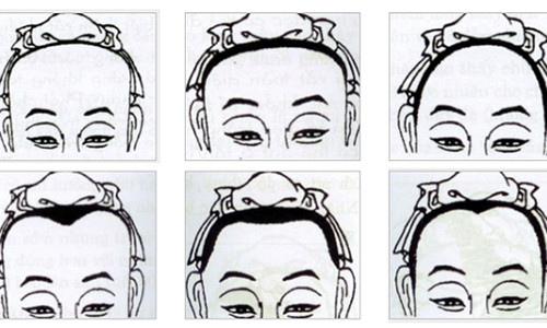 Nguoi co tran hinh nay tuong lai kieu gi cung giau sang phu quy