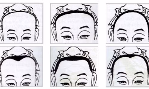 Nguoi co tran hinh nay tuong lai kieu gi cung giau sang phu quy