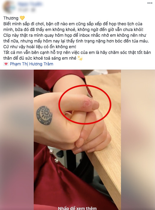 Huong Tram lien tuc mat ngu, stress den muc tu boc tay ri mau-Hinh-2