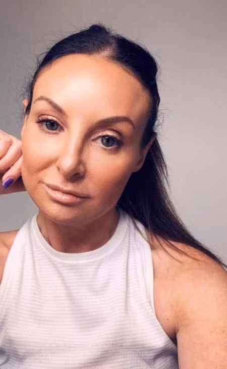 Sau 3 ngày điều tri, mũi của Shari đã trở lại bình thường. Ảnh: The Sun