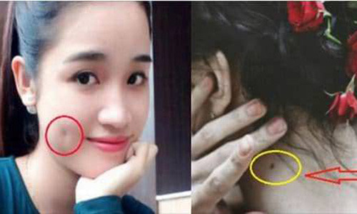 Van menh nguoi co ma lum dong tien, not ruoi truoc nguc hoac sau gay