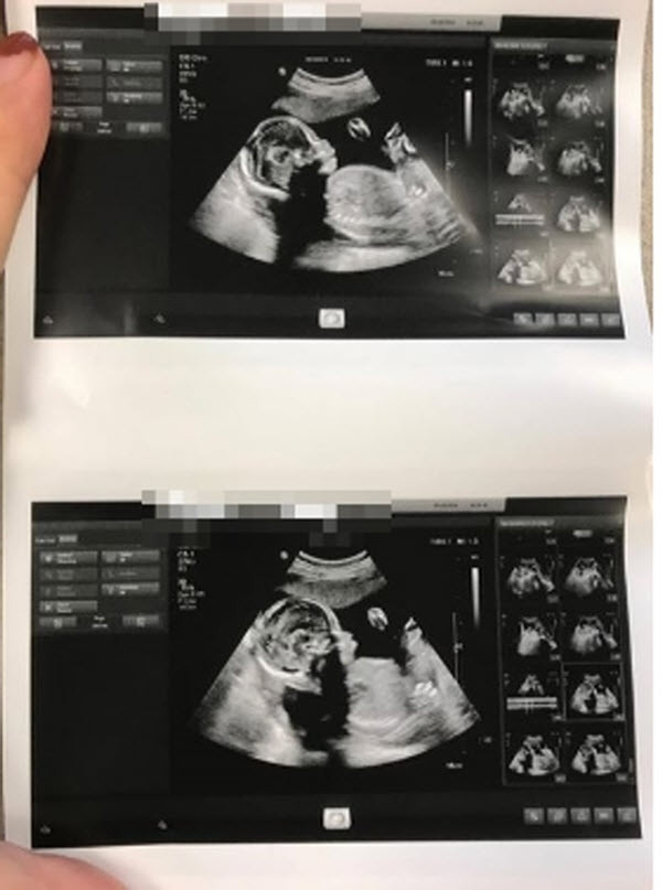 Me tho Phat thue giang ho dan mat co gai co bau voi con trai