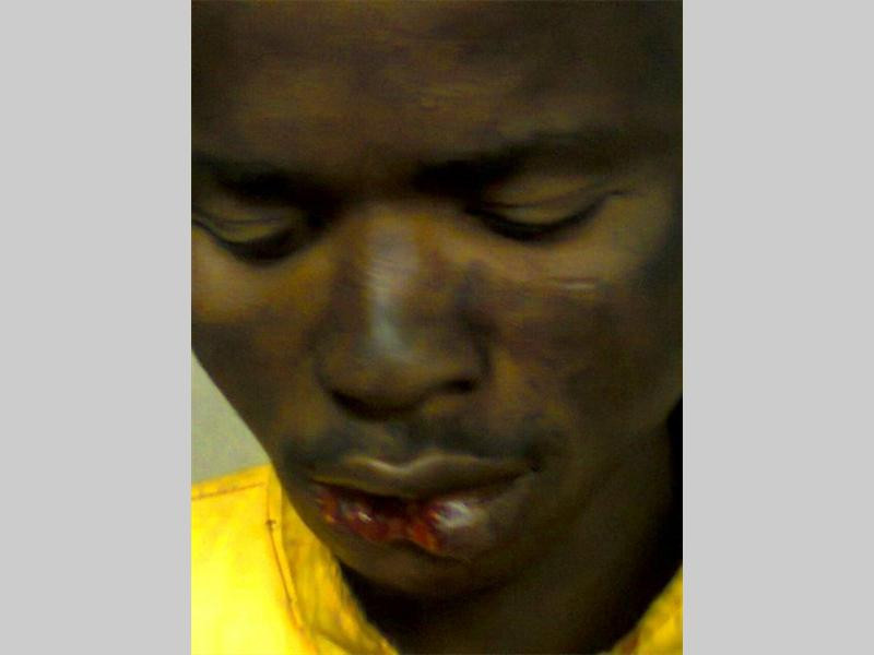 Gia vo xach do giup roi noi thu tinh, yeu rau xanh bi can rach moi