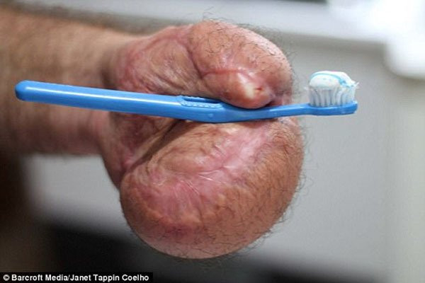 Bac si khau tay nguoi dan ong vao da day va cai ket bat ngo-Hinh-2