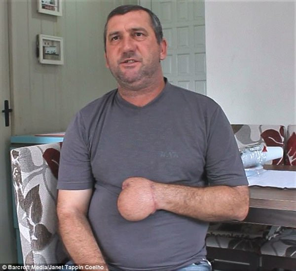 Bac si khau tay nguoi dan ong vao da day va cai ket bat ngo-Hinh-3