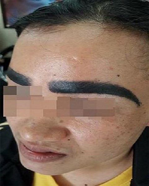 Seo loi, lom nhu “o trau, o ga” tren mat vi thich xam vo toi va