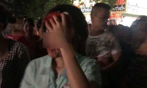 Xot xa nguoi vo bi chong danh den chay mau dau phai nhap vien