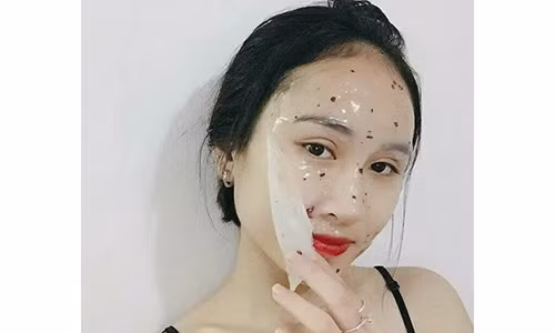 Mặt nạ collagen hoa hồng giúp dưỡng trắng, trị mụn, ngăn ngừa lão hóa da cực kỳ hiệu nghiệm - Ảnh: Internet