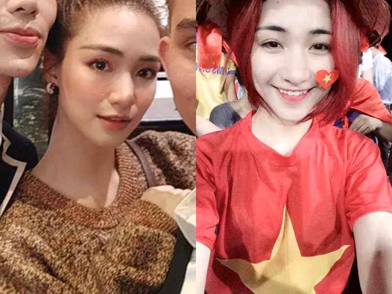 Hoa Minzy lo guong mat khac la, ro tin don phau thuat tham my-Hinh-2