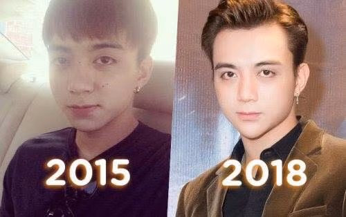 Trước sự thay đổi của gương mặt, Soobin Hoàng Sơn khẳng định tất cả do tăng cân.