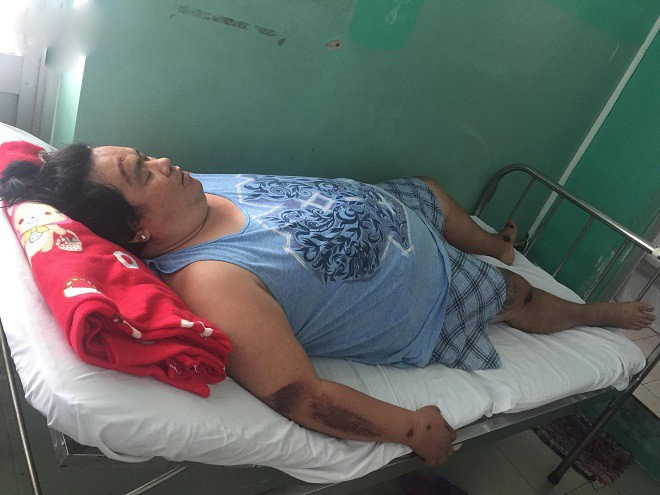 Bi an tu giac mo mang tinh diem bao cua Hoang Map