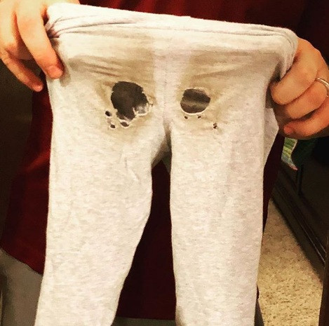 Tình trạng chung của mọi đứa trẻ.