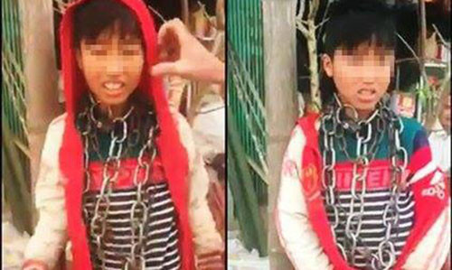 Cháu N. bị dây xích quấn quanh người và khóa lại (ảnh nguồn facebook)