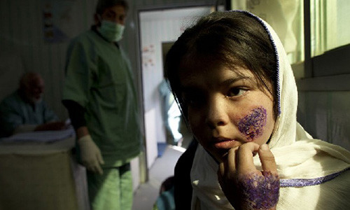 "Bệnh thánh chiến", một căn bệnh ghê rợn làm nạn nhân bị thối rữa từ bên trong, bắt đầu từ mặt.