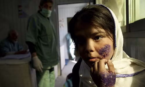 "Bệnh thánh chiến", một căn bệnh ghê rợn làm nạn nhân bị thối rữa từ bên trong, bắt đầu từ mặt.