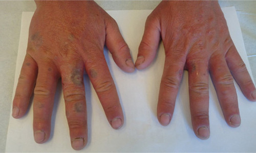 Chang trai hoa zombie vi nuoc chanh va 