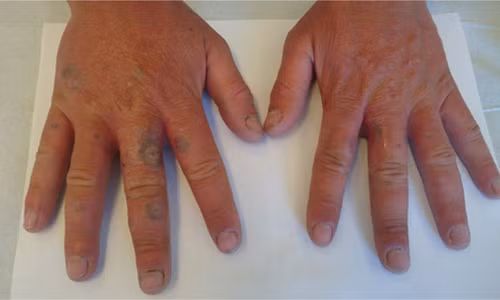 Chang trai hoa zombie vi nuoc chanh va 