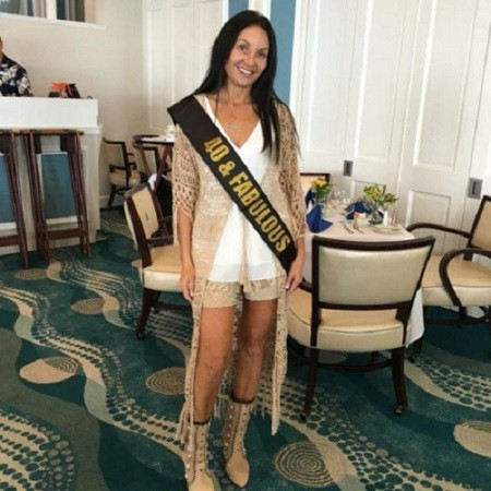 Shari Manchon đã làm mũi mới để chào đón sinh nhật lần thứ 40 của mình. Ảnh: The Sun