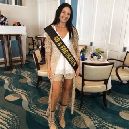 Shari Manchon đã làm mũi mới để chào đón sinh nhật lần thứ 40 của mình. Ảnh: The Sun