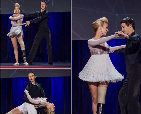 Những năm tháng huấn luyện cực khổ cộng với ý chí sắt đá đã giúp một cựu vũ công với đôi chân bị cắt cụt có thể nhảy trở lại.