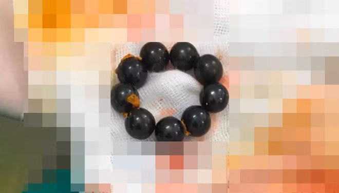 Be trai bi ban ep nuot bi sat noi gi khi tinh lai sau phau thuat