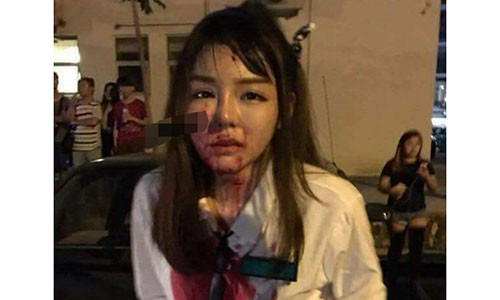 Thiếu nữ xinh đẹp bị tên cướp đâm dao vào mặt.