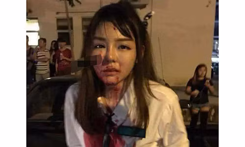 Thiếu nữ xinh đẹp bị tên cướp đâm dao vào mặt.