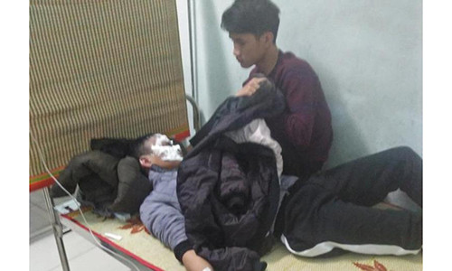 Bệnh nhân V. đang được điều trị tích cực tại Bệnh viện Đa khoa Kỳ Anh.