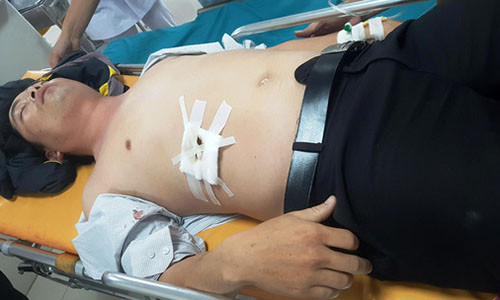 Thầy T., hiện đang được cấp cứu tại Bệnh viện Việt Nam – Cu Ba Đồng Hới.