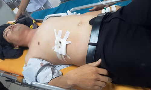 Thầy T., hiện đang được cấp cứu tại Bệnh viện Việt Nam – Cu Ba Đồng Hới.