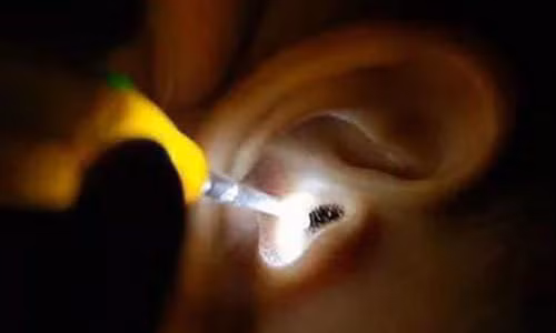 Côn trùng chui vào tai là một tai nạn nguy hiểm, cần sự giúp đỡ của bác sĩ nhanh chóng - Ảnh: SCMP