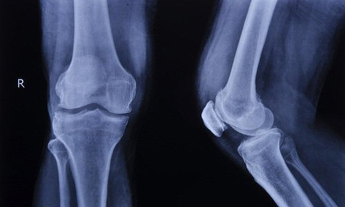 Giai ma nhung su that ve xuong nguoi ma lau nay ai cung nham lan