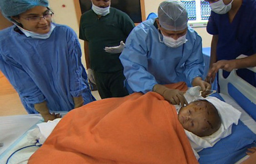 Nếu như không chữa trị kịp thời thì não úng thủy sẽ tác động đến dây thần kinh trung ương và để lại nhiều di chứng trầm trọng như viêm màng não mủ, mù, điếc, liệt, chậm phát triển thần kinh.