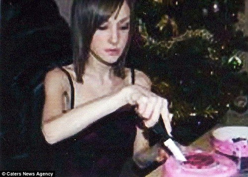 Cô còn lạm dụng cả thuốc nhuận tràng để hỗ trợ giảm cân. Chế độ ăn thiếu khoa học này đã khiến cô mắc chứng biếng ăn.