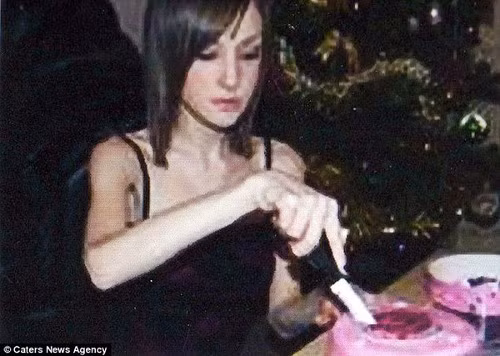 Cô còn lạm dụng cả thuốc nhuận tràng để hỗ trợ giảm cân. Chế độ ăn thiếu khoa học này đã khiến cô mắc chứng biếng ăn.