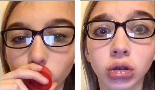 Gần đây, giới trẻ lại chuyển sang phương pháp “bơm môi” bằng cách dùng cốc và hít mạnh sao cho miệng cốc dính chặt vào môi đến khi đôi môi sưng vù lên mới thôi. Ảnh: vhb-group