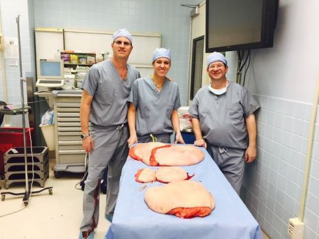 Sau đó là cả quá trình cố gắng giảm cân khó nhọc. Sau khi giảm cân, lớp thịt thừa bèo nhèo đổ xuống thân dưới khiến anh vô cùng khó di chuyển. Hồi tháng 4 vừa qua, người béo nhất thế giới này đã được đội ngũ bác sĩ tại bệnh viện Lenox Hill, New York, cắt bỏ hơn 25 kg da thừa