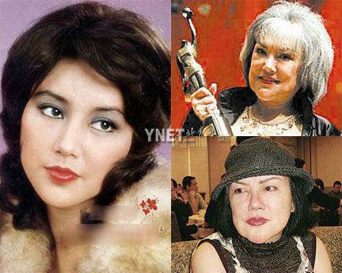 Sốc với sắc đẹp tuyệt trần của thảm họa thẩm mỹ thời trẻ - Hình 9 Soc voi sac dep tuyet tran cua tham hoa tham my thoi tre-Hinh-9