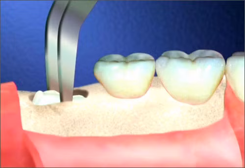 Rùng mình xem quy trình nhỏ rang khon hiẻm hóc