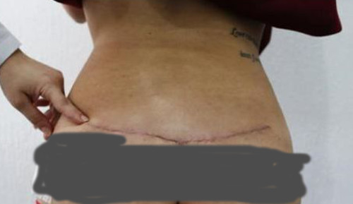 Những vết sẹo sẽ vẫn còn và phải mất một thời gian mới có thể biến mất hoàn toàn.