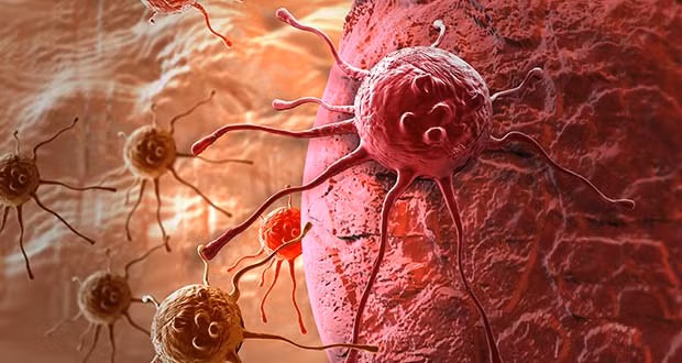 4 loai thuc pham ho tro dieu tri ung thu de kiem